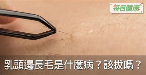 身體長毛|乳頭邊長了毛，是什麼病？該不該拔？讓名醫一次解釋給您聽｜每